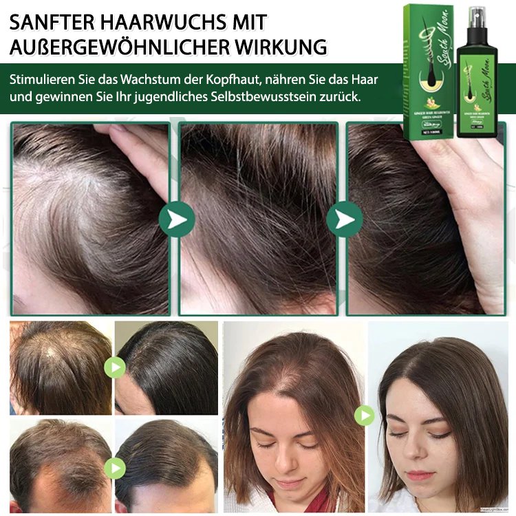 [60 Tage für dichtes Haar]Haarwachstumsspray mit Ingwer