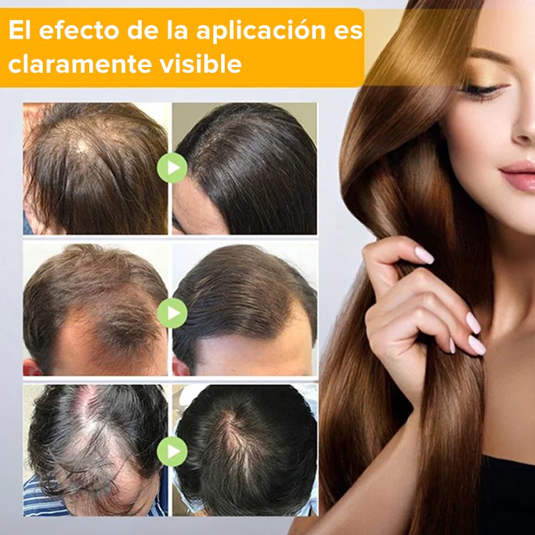 Spray para el crecimiento del cabello con biotina EELHOE