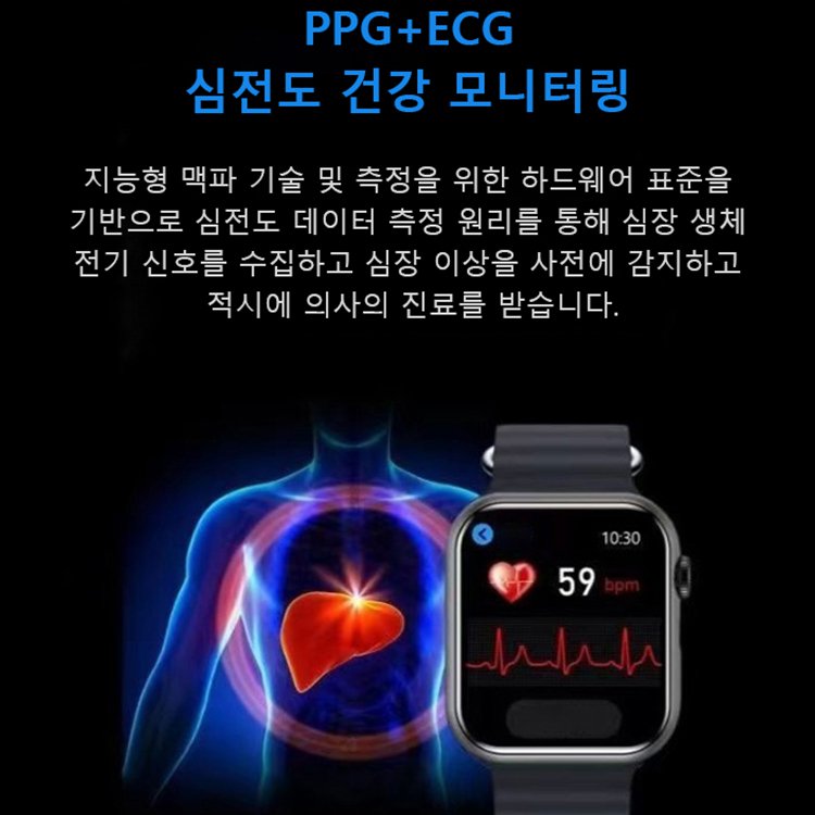 신형 비침습 혈당 광치료 스마트워치