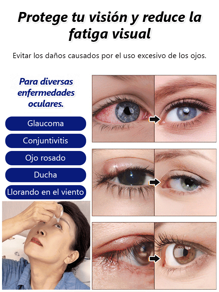 Gotas para los ojos de luteína