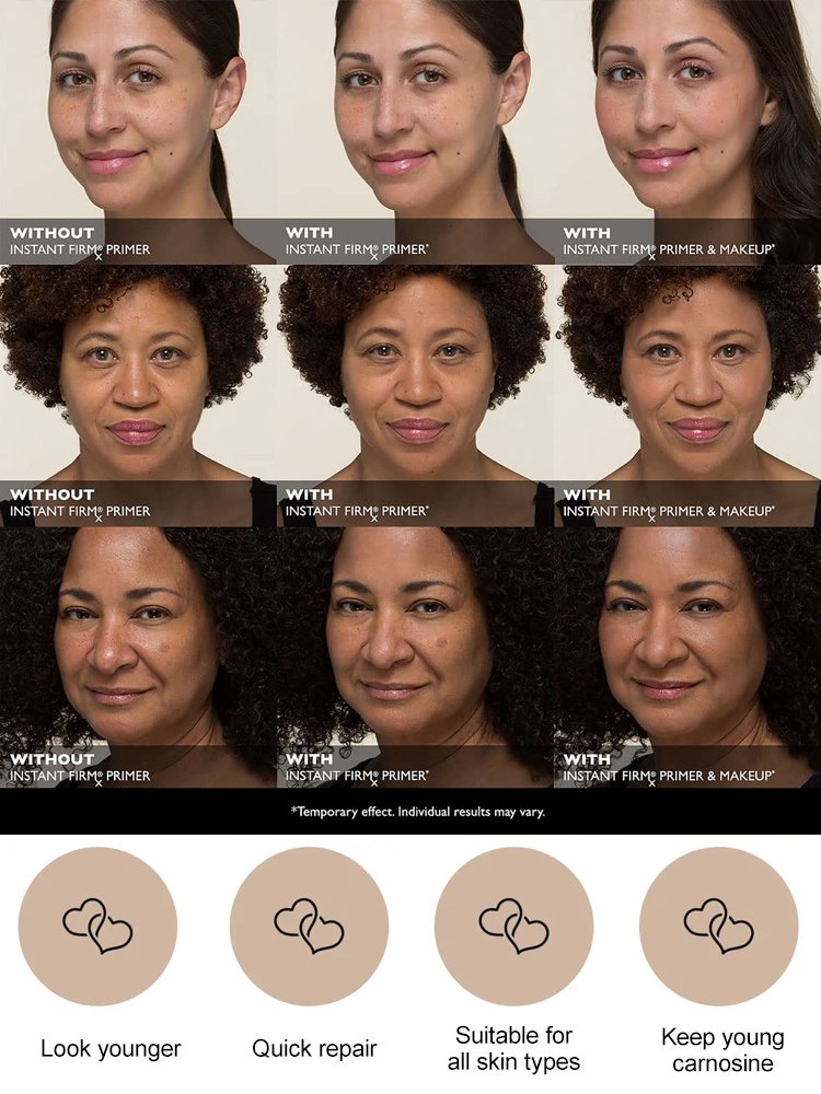 peterthomasr Eye Tightener