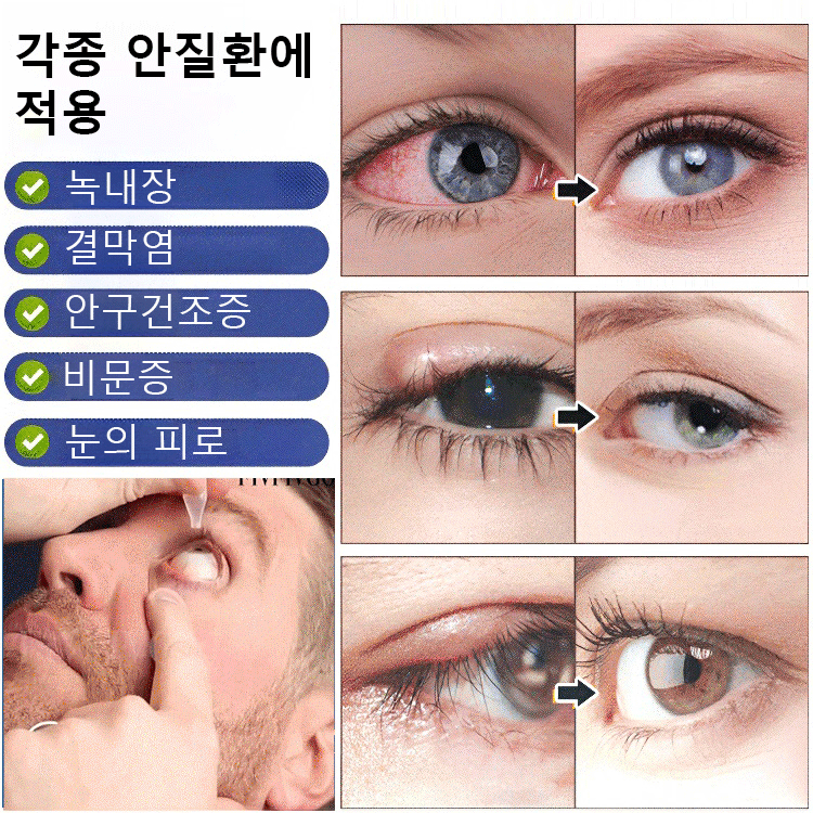 시력 교정 안약