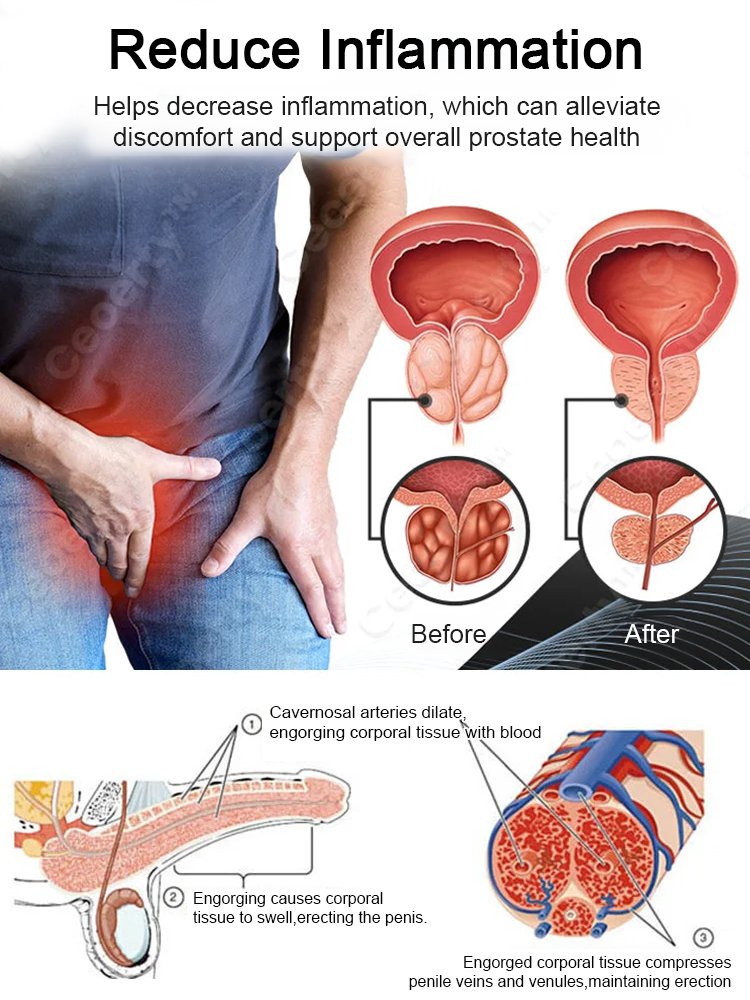 Prostate Care Sonic Bracelet