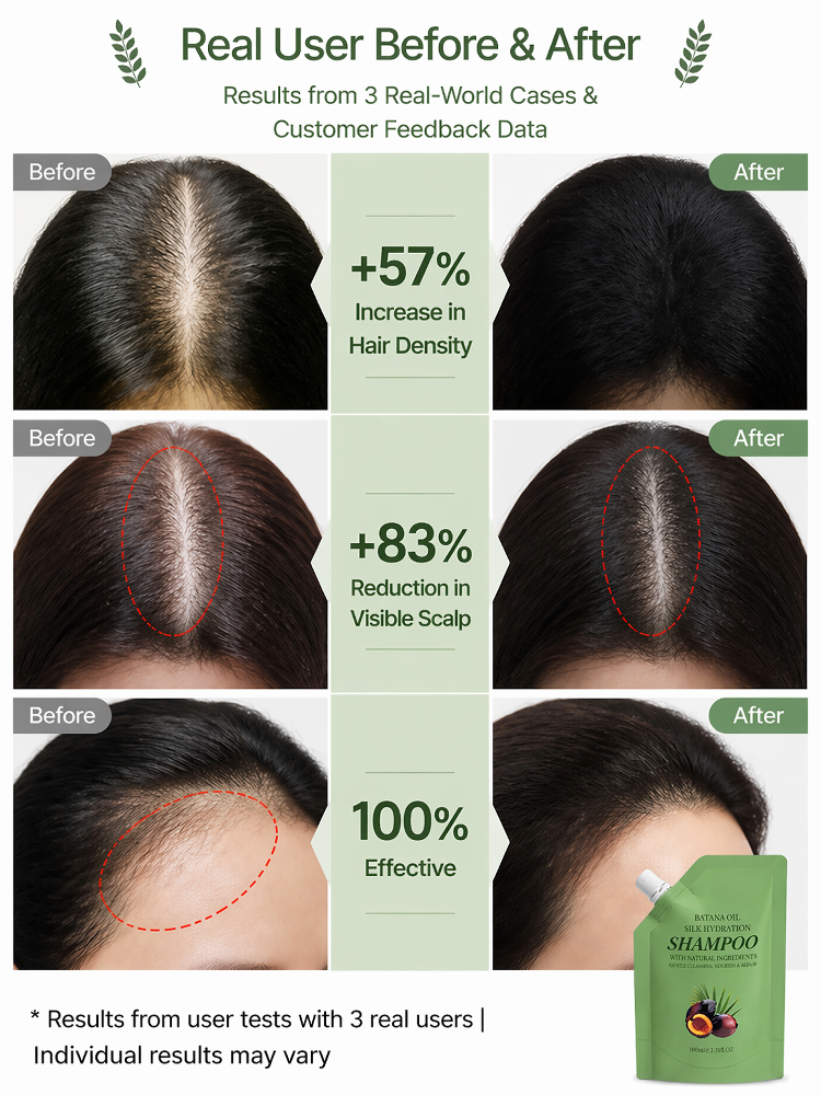 Anti-Hair Loss & Hair Growth Shampoo, Achieve Zero Hair Fall