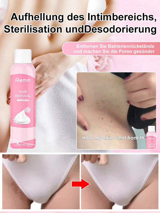 Remo Haarentfernungs-Mousse