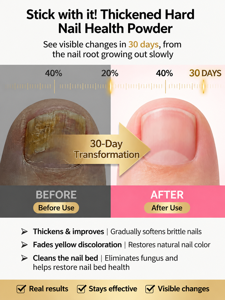 SL-[Painless and Gentle Nail Replacement] Herbal Nail Remover Oil