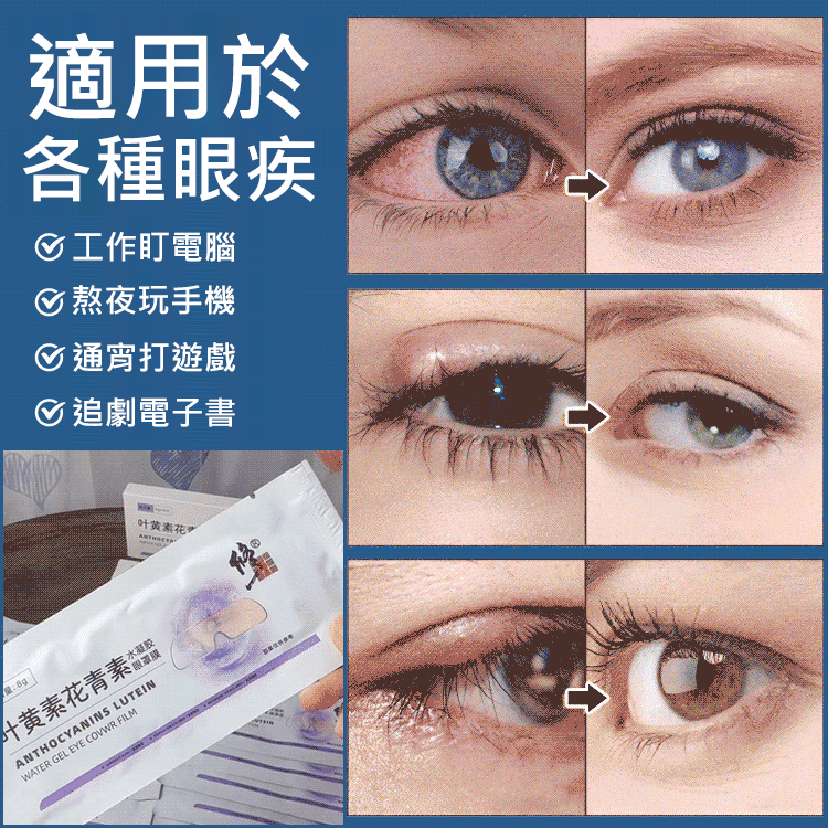 葉黃素花青素眼貼