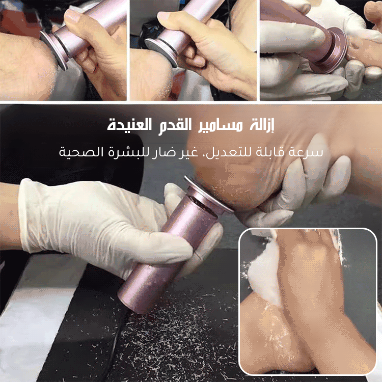 مبرد القدم الكهربائي