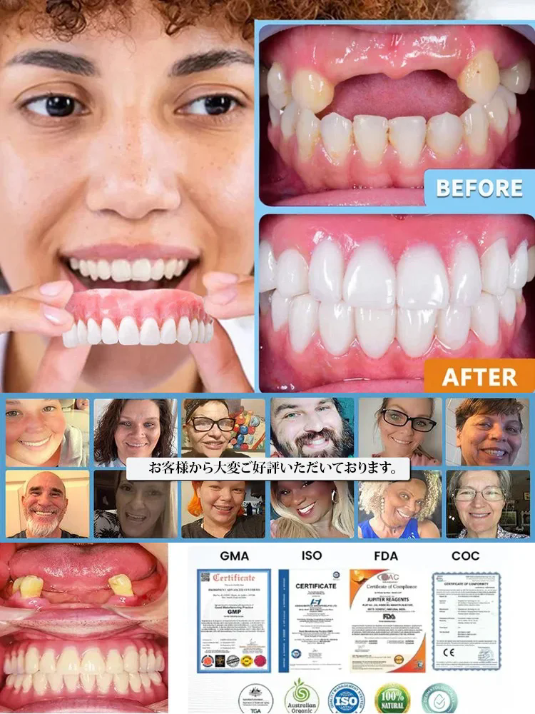 審美用マウスピース，スイス輸入品、口いっぱいのスイス製、そして高貴な身分の象徴！！