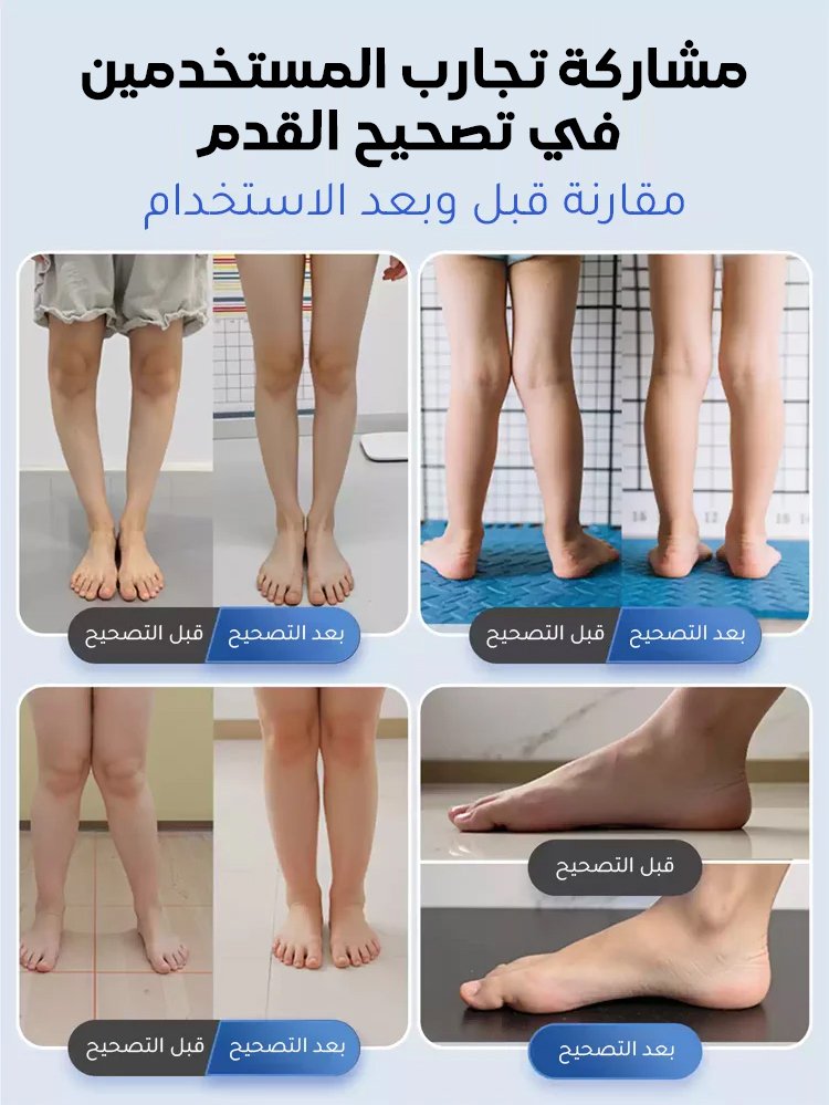 جورب تصحيح قوس القدم والتهاب اللفافة الأخمصية（تم تطويره من قبل الفريق الكندي لتصحيح القدم）
