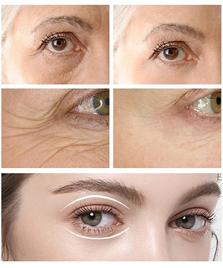 Sofortiges straffendes Augenserum