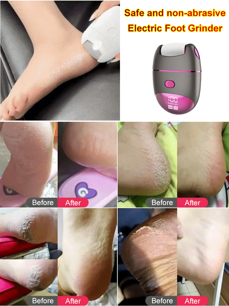 Multifunctional electric foot grinder