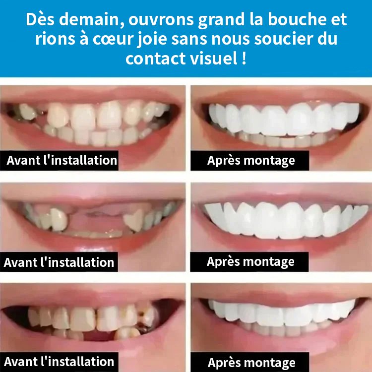 Ensemble de retouche dentaire oralhoe (colle d'alimentation)