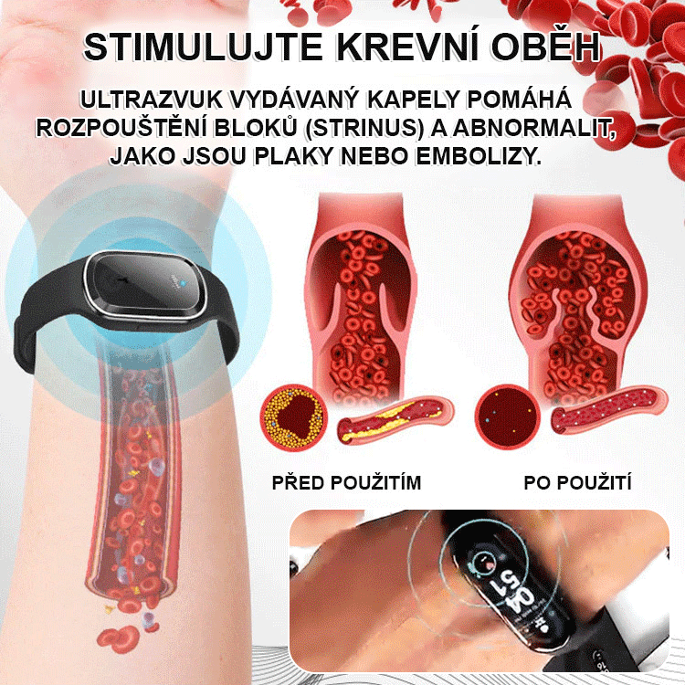 Ultrazvukový elektronický náramek na hubnutí