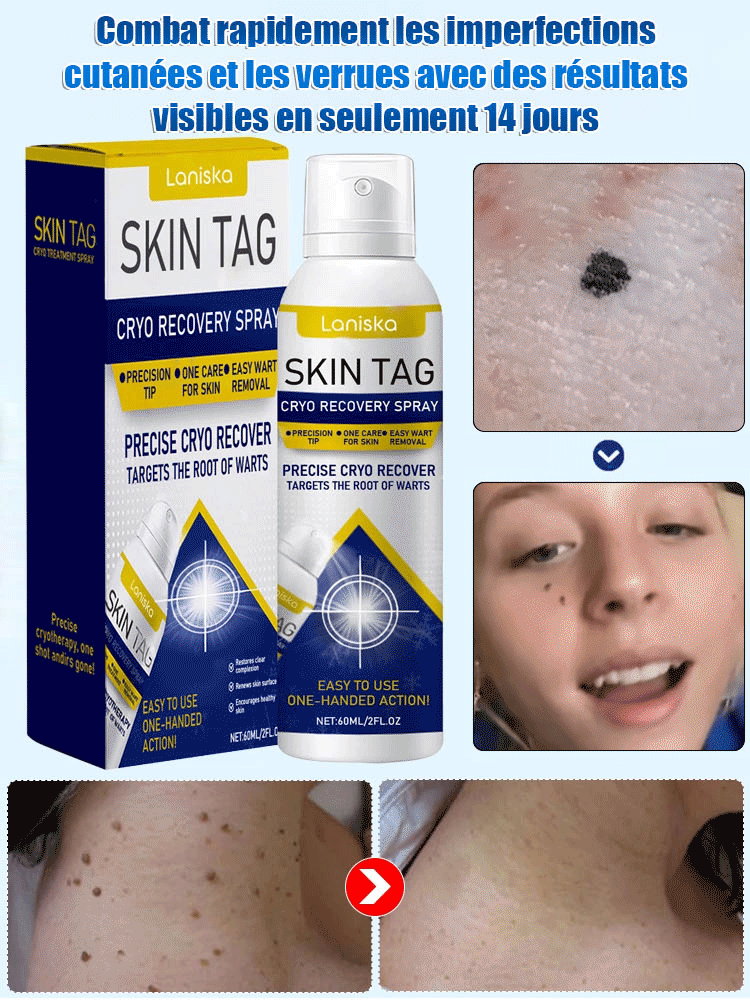 LANISKA spray de soin topique pour points de verrues