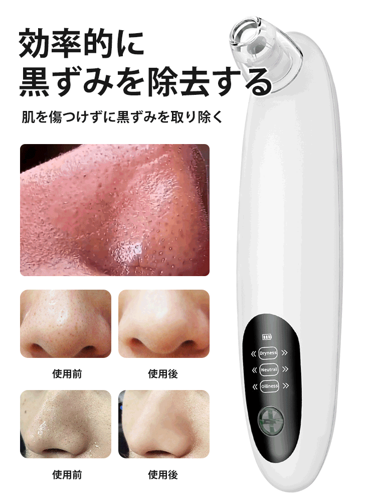 ポータブル 毛穴吸引器