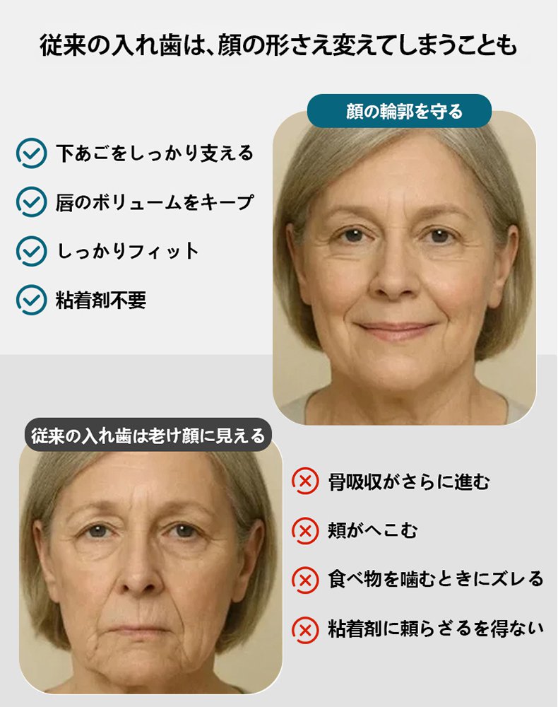 義歯入れ歯セット