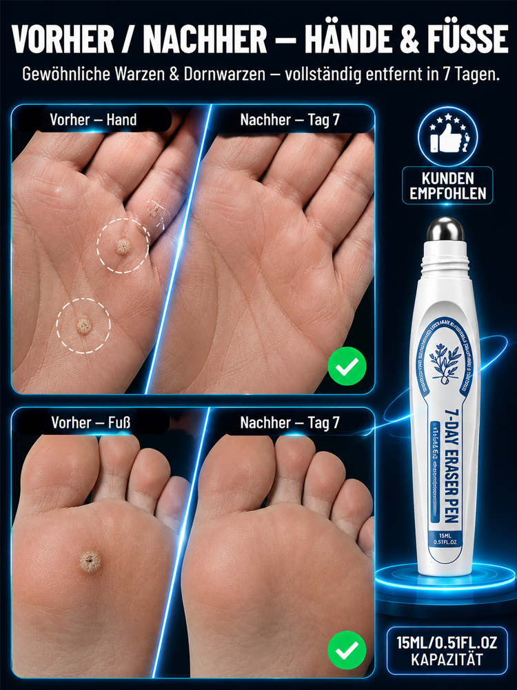 Warzen-Entferner Roll-On für glatte Haut