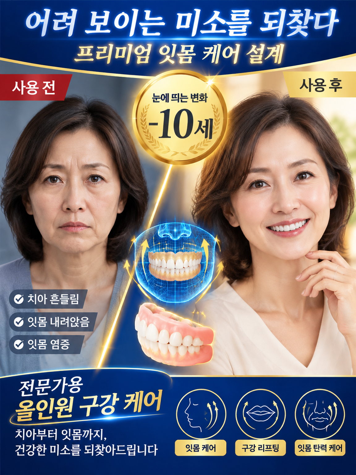 프리미엄 맞춤형 전체 틀니 세트