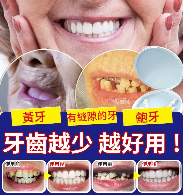 BLSEX微笑仿真假牙套