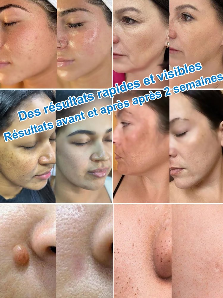 Stylo de soin portable pour la peau, nettoyant doux et lissant.