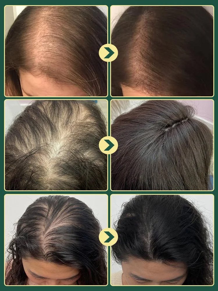 [The less hair, the better the effect] Herbal Essence Nourishing Repair Shampoo
