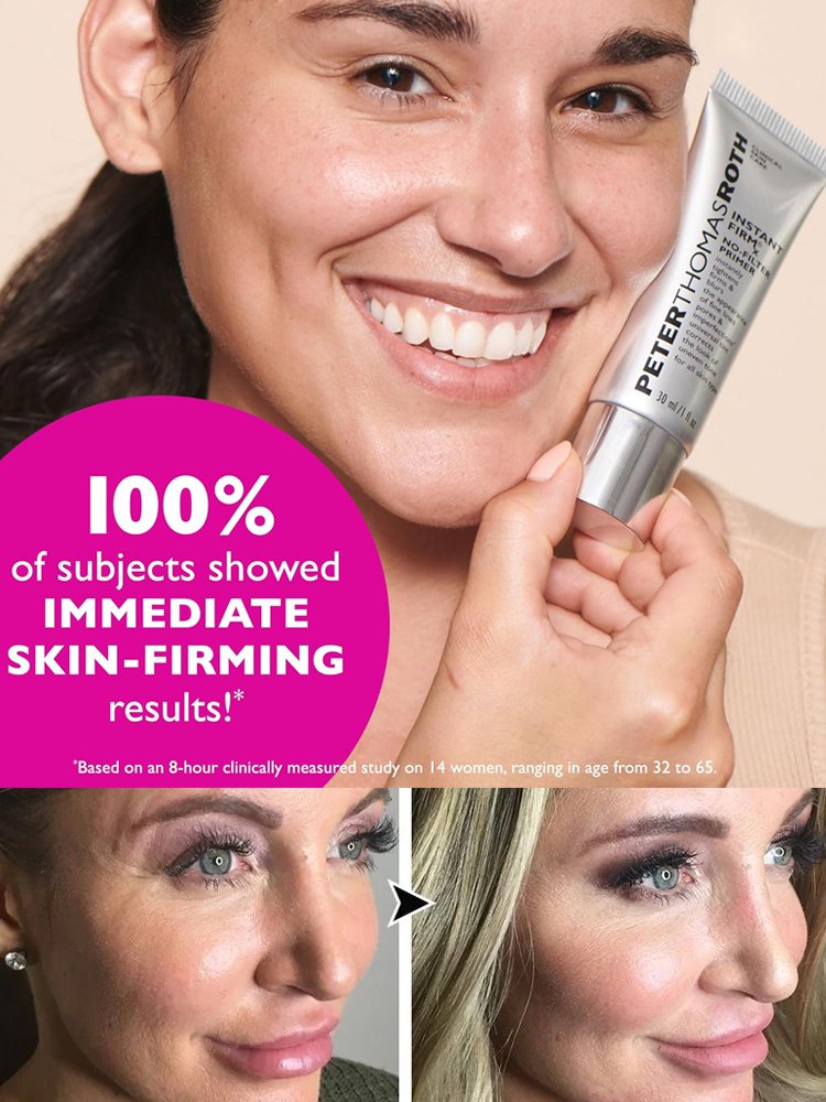 peterthomasr Eye Tightener