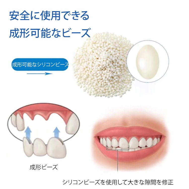 South Moon歯用接着剤