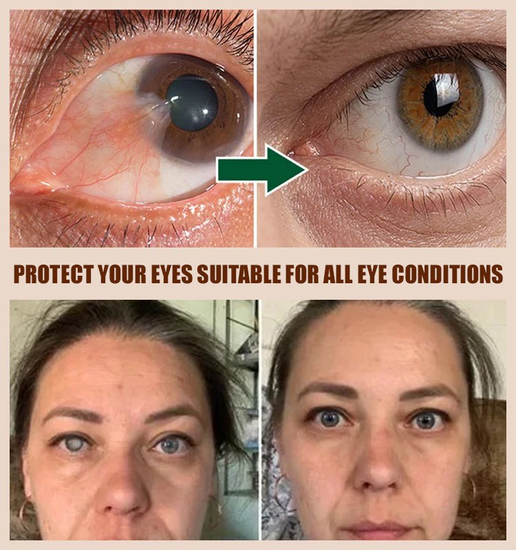 Colored eye care solution