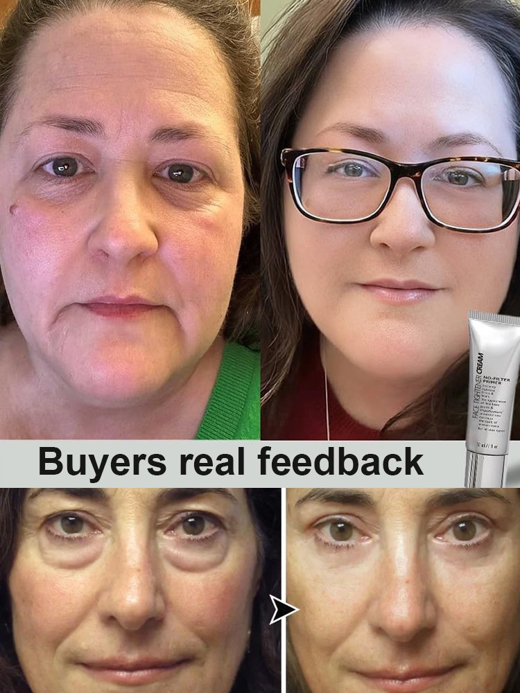 peterthomasr Eye Tightener