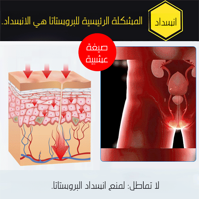 مرهم جنوب مون Gubenqianliekang 