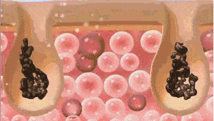 getimg (13)_看图王.gif