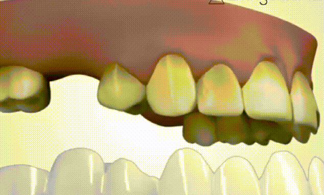 05.gif