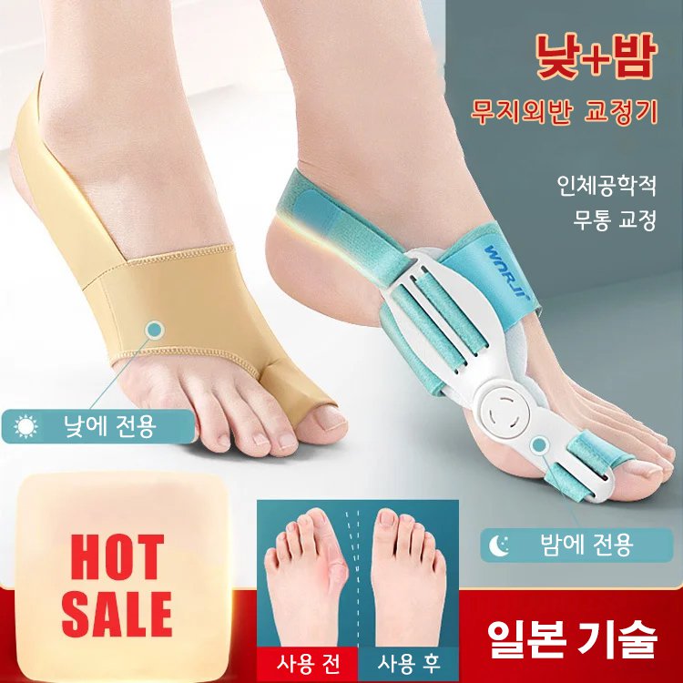 무지외반 교정기