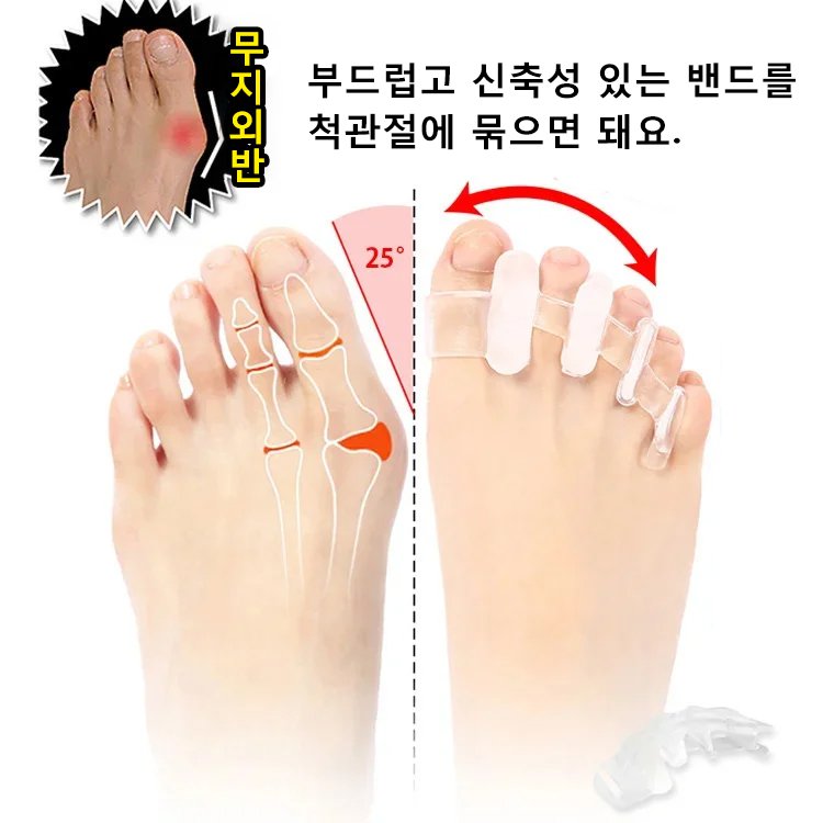 실리콘 발가락 교정기