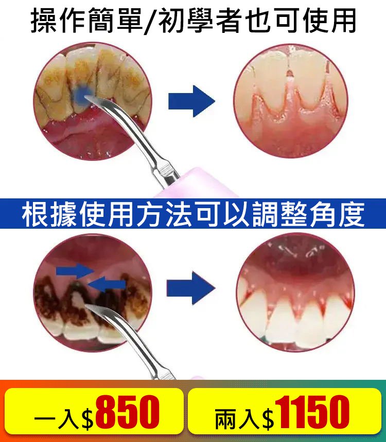洗牙儀