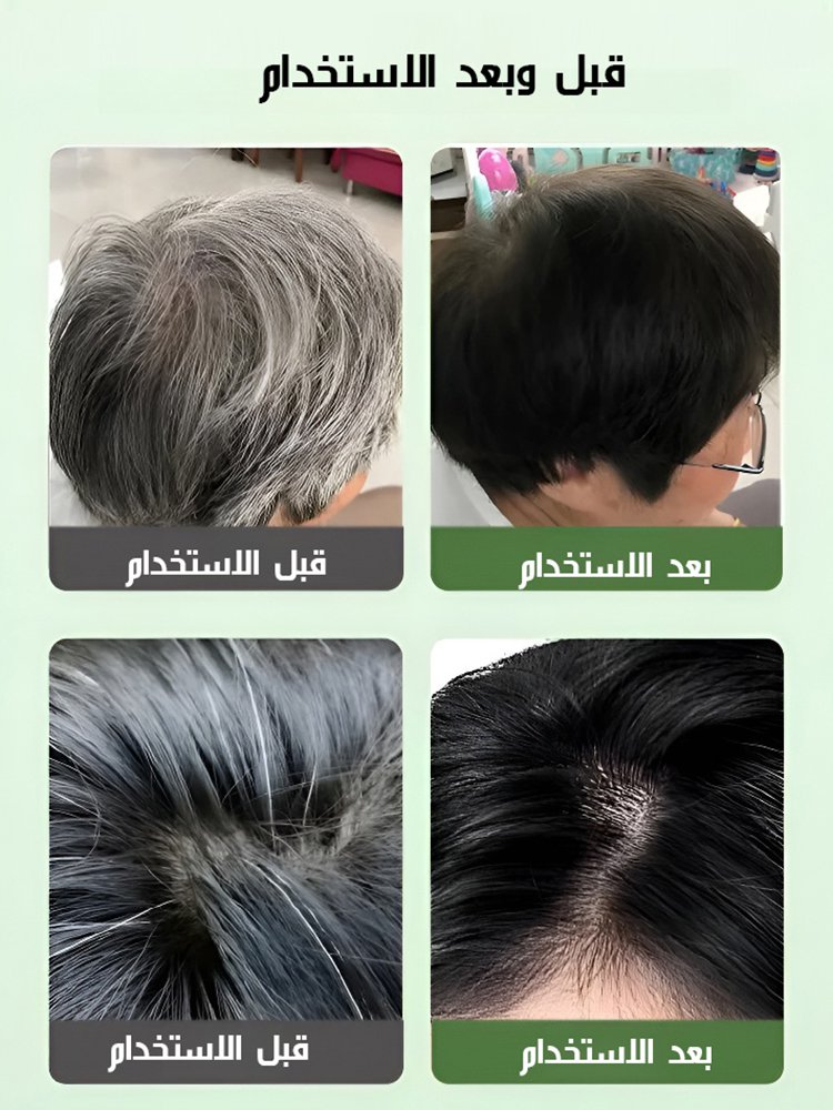 صباغة الفقاعات VOJO لتغطية الشعر الأبيض (موصى به من قبل الصالون المهني)