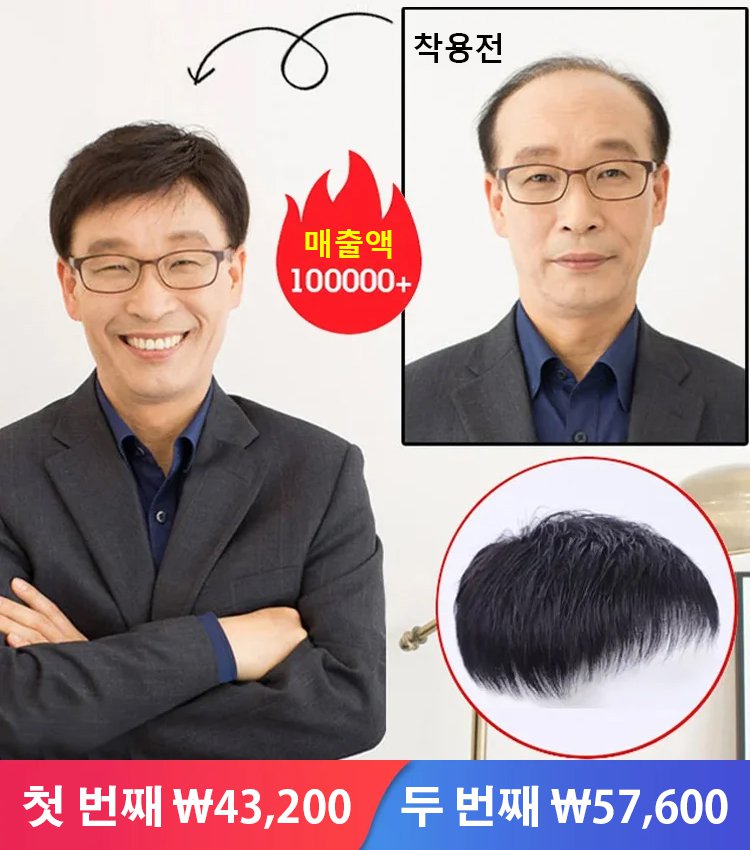 정수리 시뮬레이션 헴라인 가발