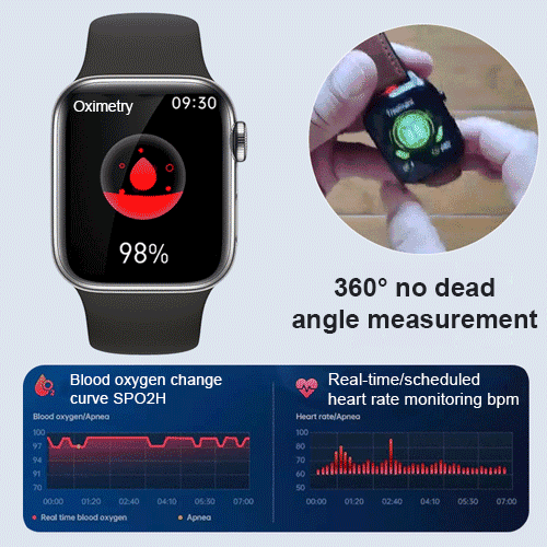 Smart Painless Blood Glucose Measurement Watch