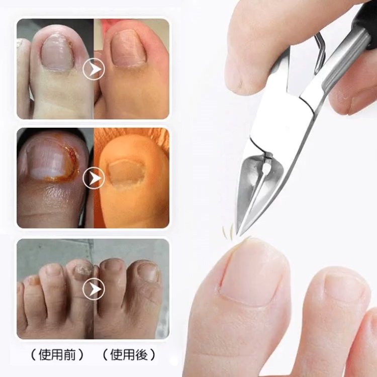 ステンレス製ニッパー型爪切り