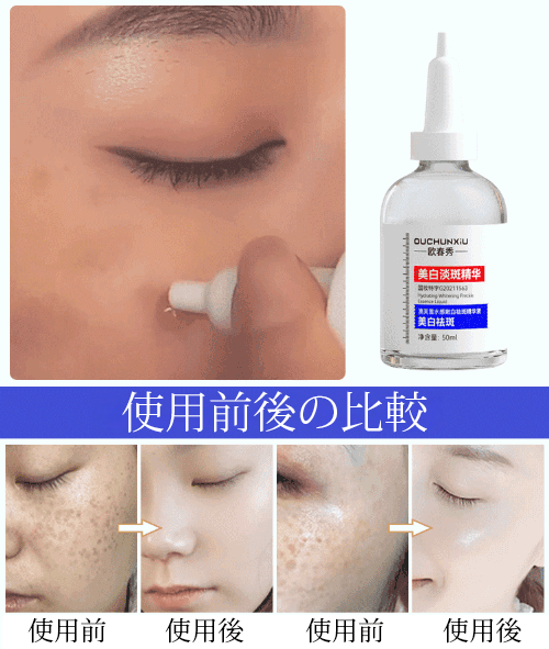 【効果なければ3倍返金】ホワイトニング &シミ取りエッセンスセット、エステ業界”門外不出”の美容液