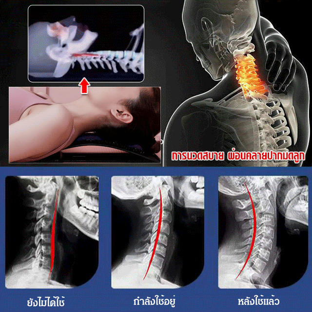 [พร้อมแม่เหล็ก] อุปกรณ์นวดกระดูกเอว ผ่อนคลายบรรเทาอาการปวดเอว