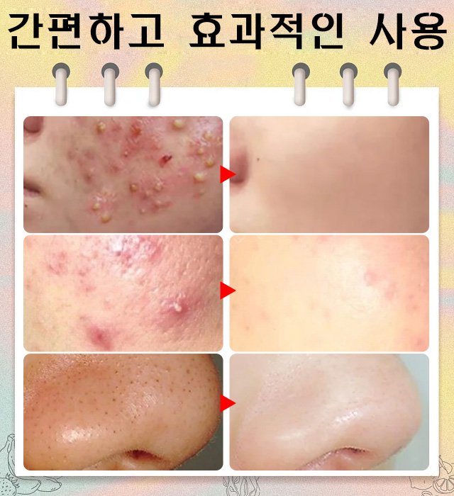 고정밀 고경도 세포 집게