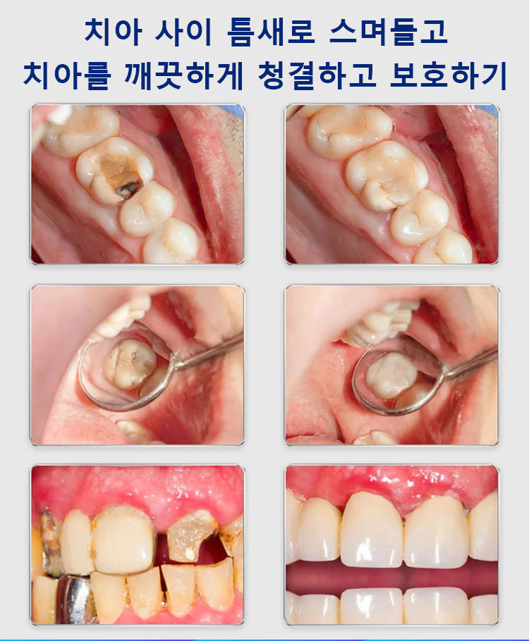 고체 치약 츄어블